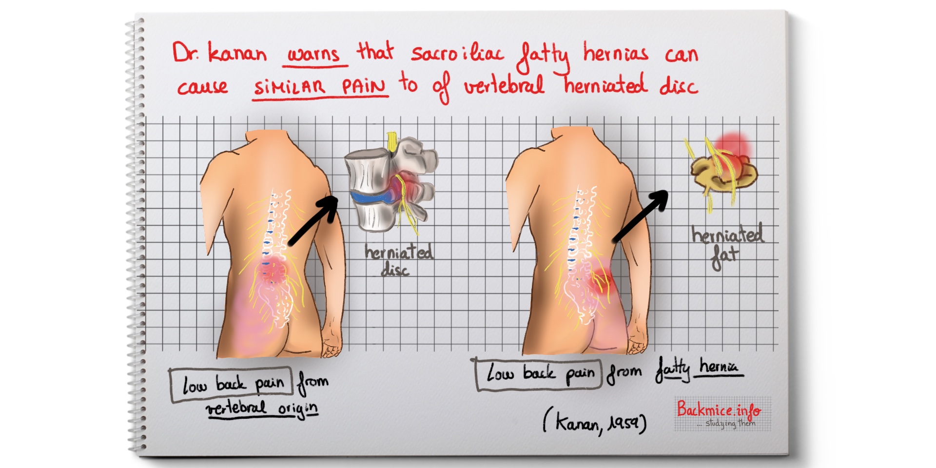 Fıtıksız Bel Ağrısı