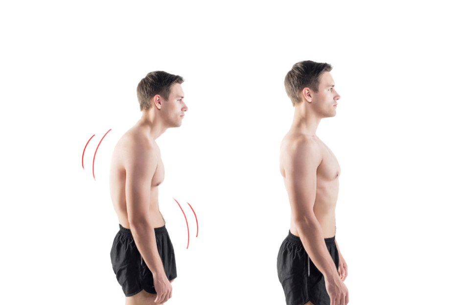 Postür Bozuklukları